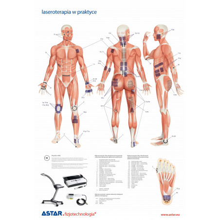 Plansza dydaktyczna laseroterapia wysokoenergetyczna w praktyce