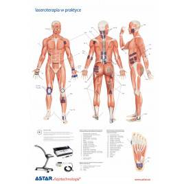 Plansza dydaktyczna laseroterapia w praktyce